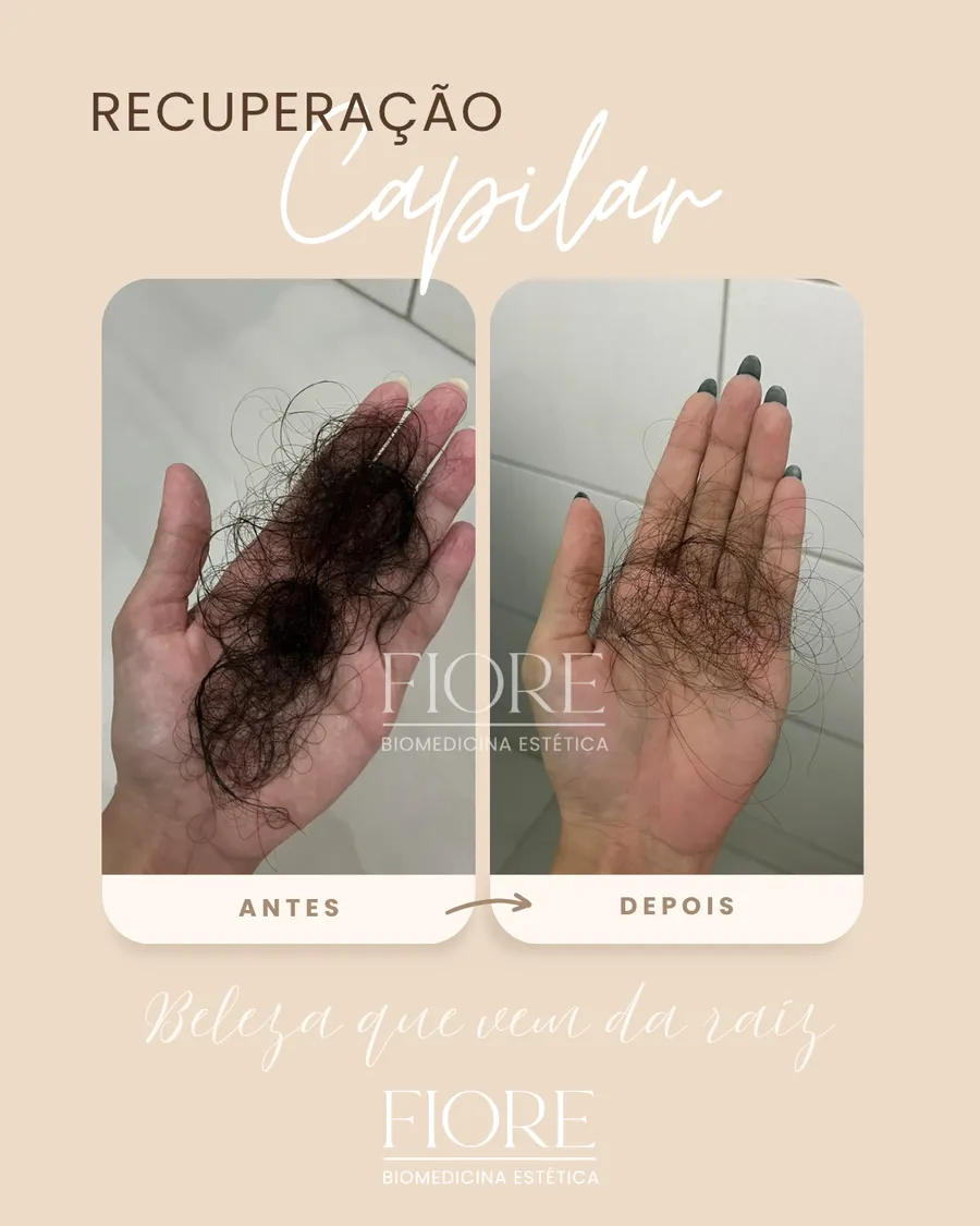 Antes e depois de recuperação capilar na Fiore
