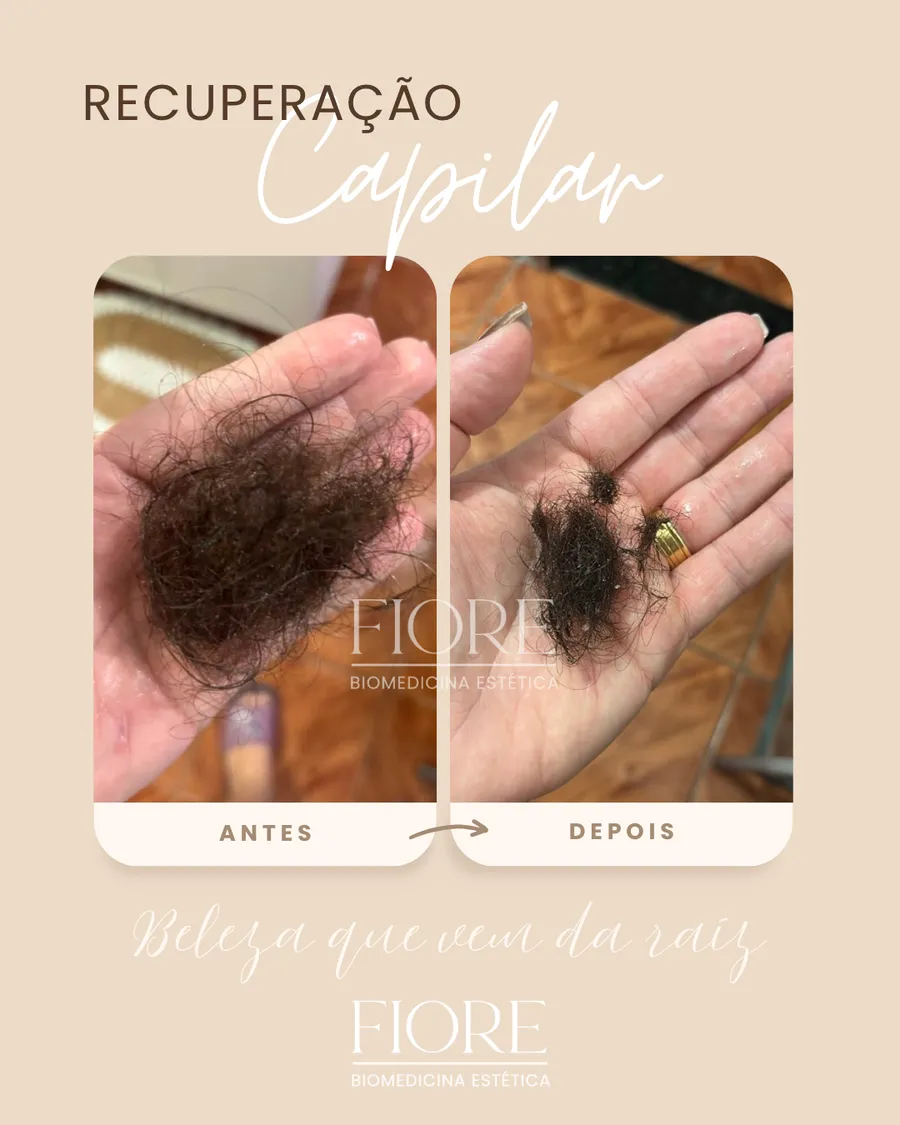 Antes e depois de recuperação capilar na Fiore